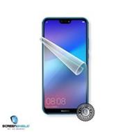 SCREENSHIELD HUAWEI P20 LITE